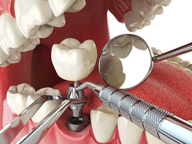 Best Broken or Cracked Tooth Emergency Dentist in Taylor, MI